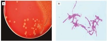 Diagnosis of Mud Fever