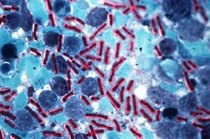Bacillus anthracis