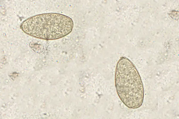 Diagnosis of Liver Fluke in Cattle