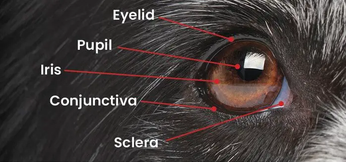 Types of Cataract