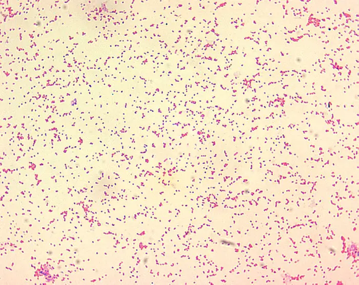 Diagnosis of Brucellosis