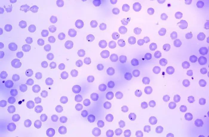 Diagnosis in Anaplasmosis