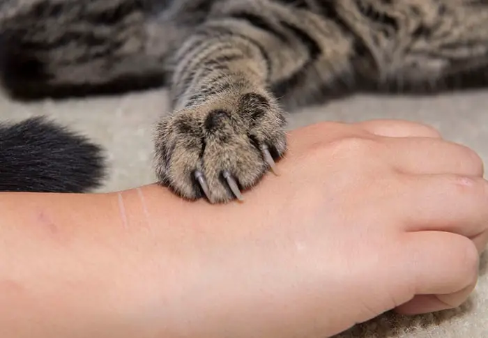 Clinical Signs of Cat Scratch Disease