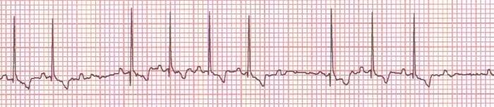 Reading ECG in Dogs