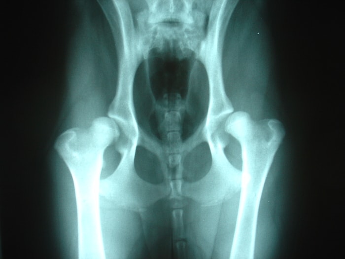 Bi-Lateral Hip Displacement in Dogs