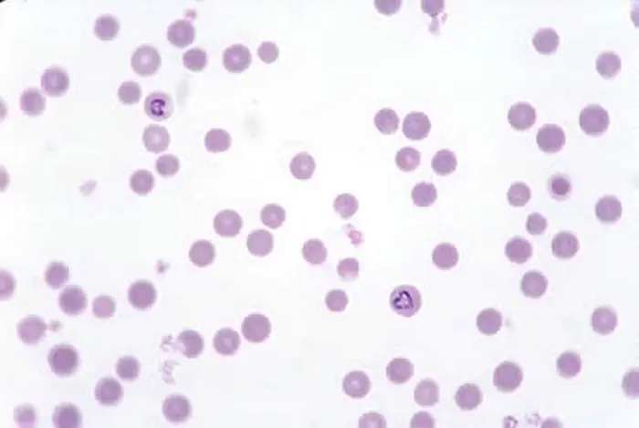 Babesia organism in RBC