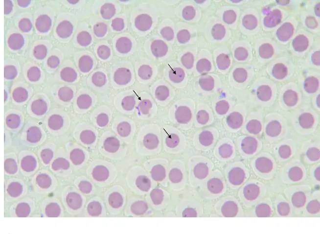 Diagnosis of Theileriosis in Cattle