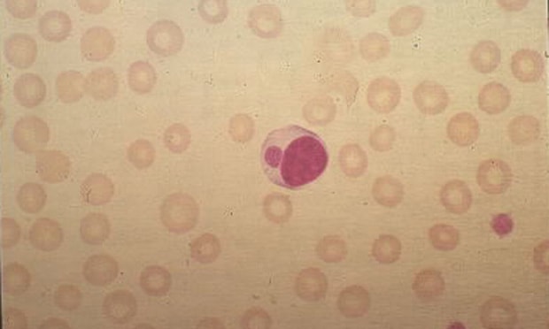 Ehrlichia Canis in Blood Smear