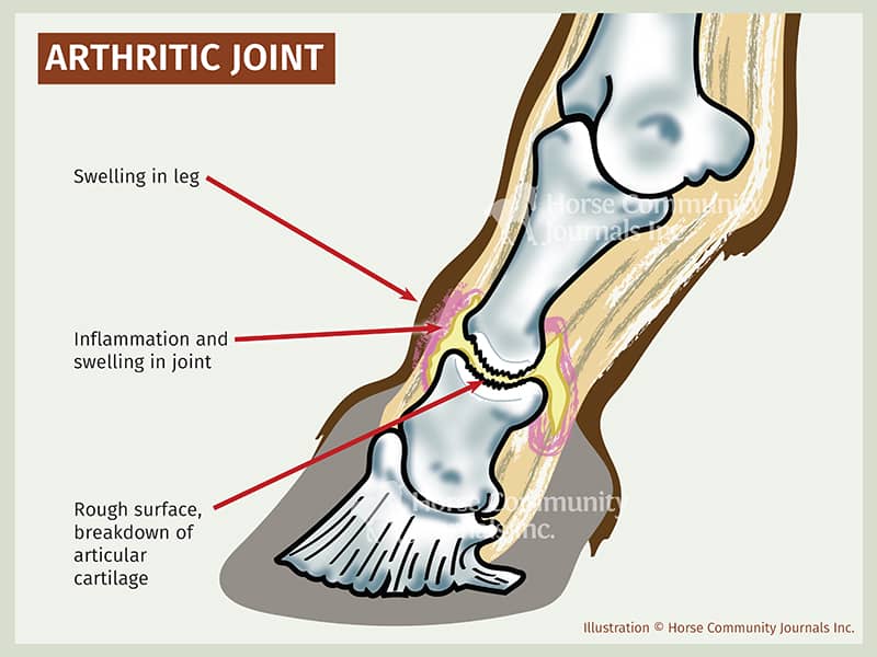 Joint Affected by Arthritis