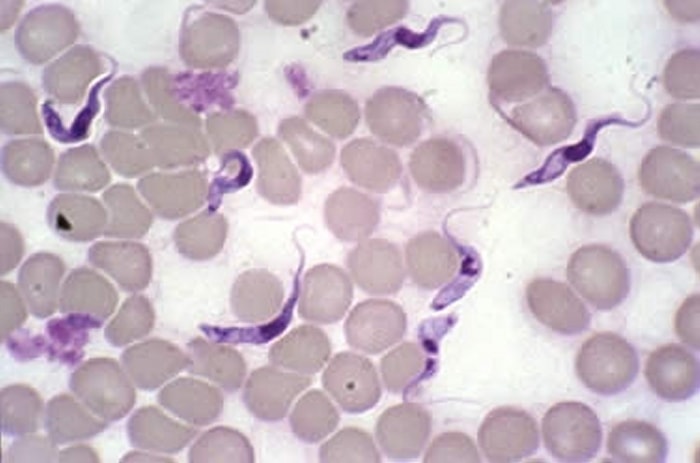 Trypanosoma organism in blood