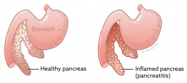 Causes of Feline Pancreatitis