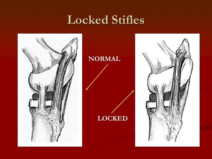 Location of Patellar Joint Locking